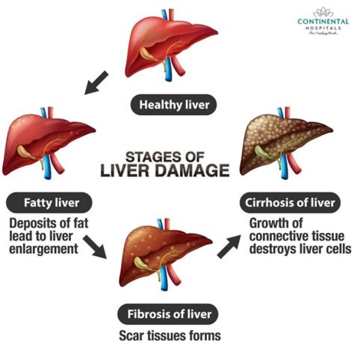 Does hoodia cause liver damage