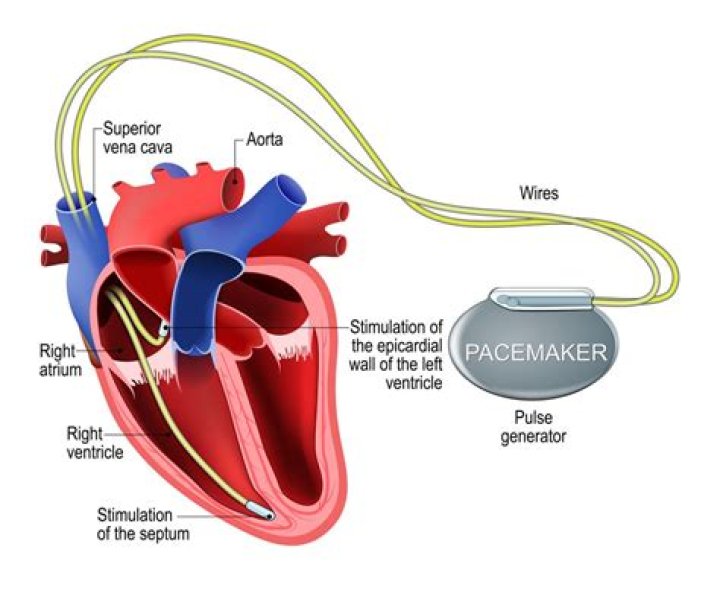 What is true of the cardiac conduction system pacemaker of the heart